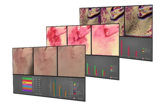 肌と向き合う、３D皮膚測定器による「ほうれい線測定」も実施