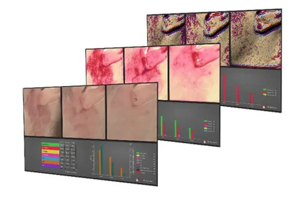 肌と向き合う、３D皮膚測定器による「ほうれい線測定」も実施