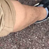 木ツ根