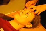 即効性あり美顔鍼✨