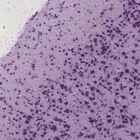 アインシュタインの脳切片  1955年以降 新潟大学脳研究所所蔵写真撮影：カールツァイスマイクロスコピー株式会社