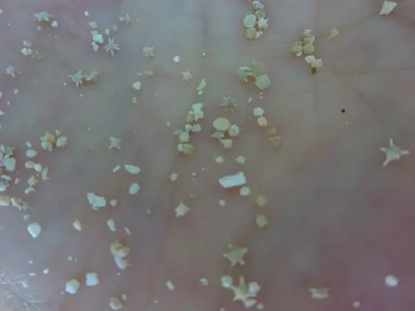 星砂